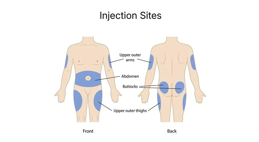 Select your injection site